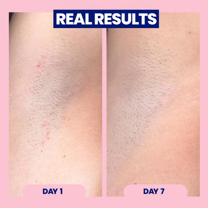Megababe Mini Après Shave (1.7 fl oz) | Travel size post-Shave & Waxing | Vacation Essential | Ingrown Hair & Razor Bump Roll-On Treatment for Women | Bikini, Armpits & Legs