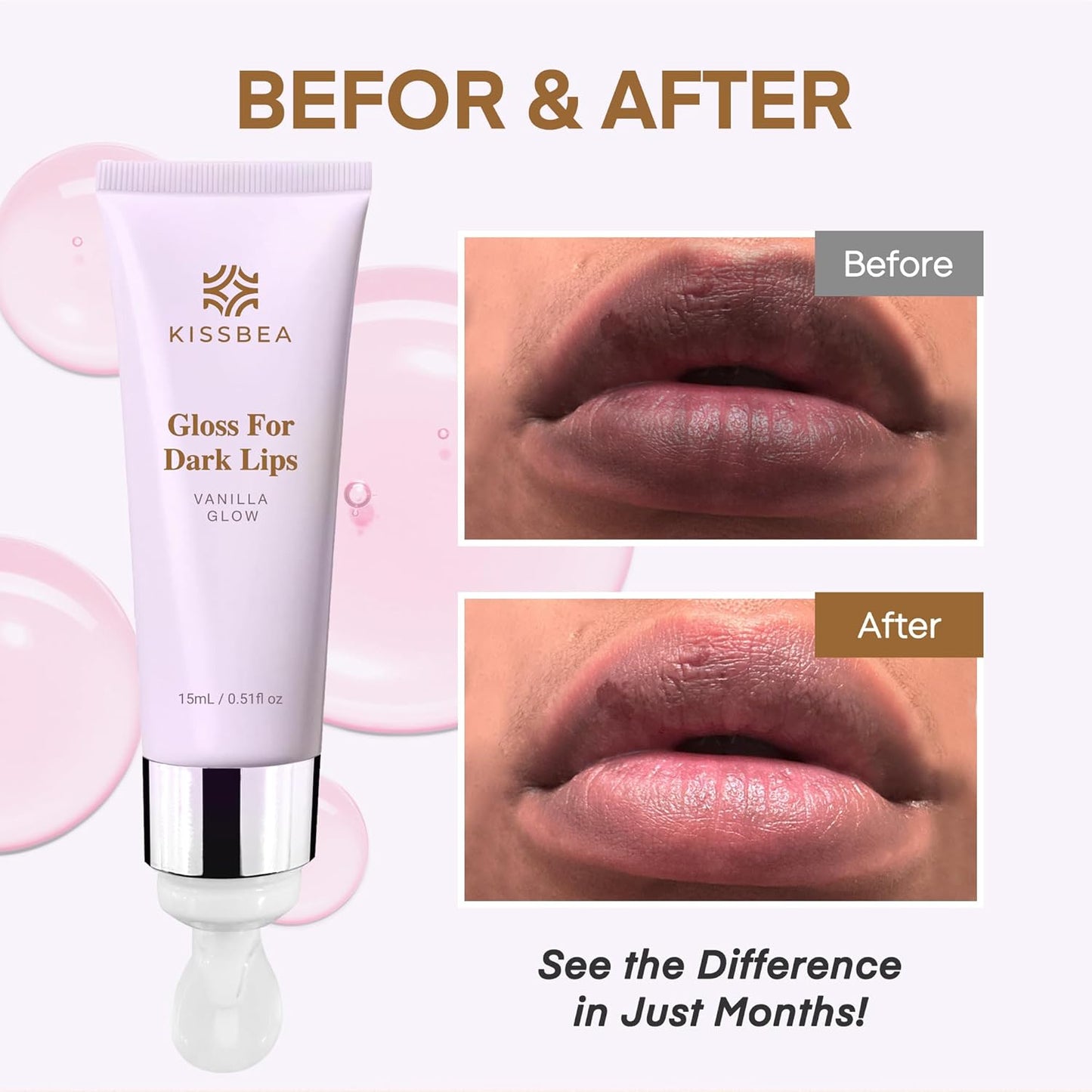 Lip Lightening for Dark Lips: for Smokers, Dry or Uneven-Toned Lips – Restores Natural Look & Moisture with VC, Lemon Peel & Licorice – Refreshing Vanilla Scent – 15 mL