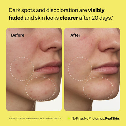 Peach Slices - Super Fade Discoloration Serum for Face (1.01 oz) - Dark Spots, Hyperpigmentation, Uneven Skin - Niacinamide Serum - Tranexamic Acid - Vegan & Cruelty Free - Korean Skin Care & Beauty